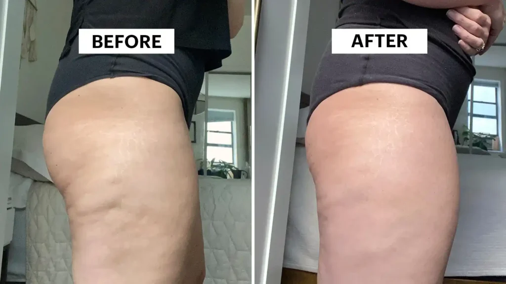 Do Toning Exercise East Grinstead Really Tackle Cellulite?