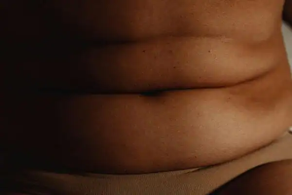 The Hidden Connection: How Stress Shapes Your Fitness and Body Composition 3 image of what stress can do on the stomach area and how Lipo 360 East Grinstead can help to change your body shape.