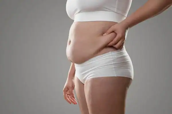 Image of stress belly East Grinstead How Lipo 360 can help manage your symptoms